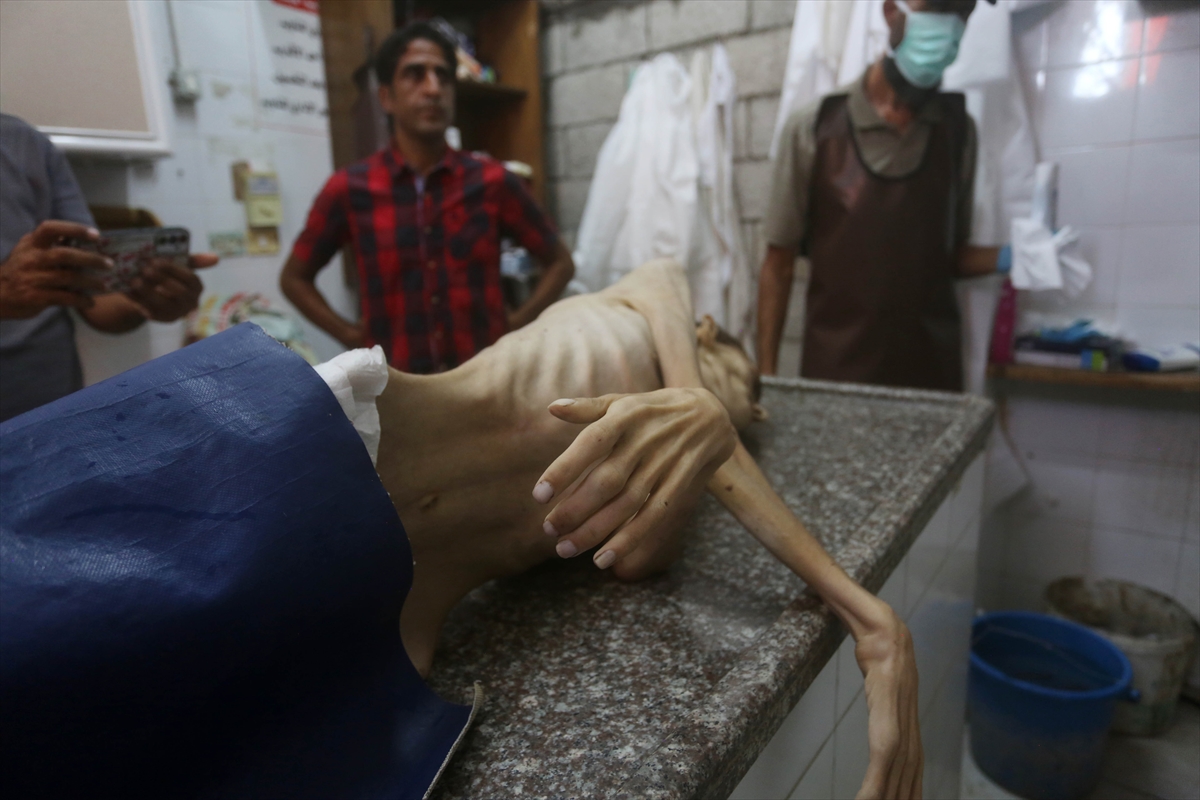 Gazze'de Yetersiz Beslenme Nedeniyle 17 Yaşındaki İsmail Hayatını Kaybetti 2