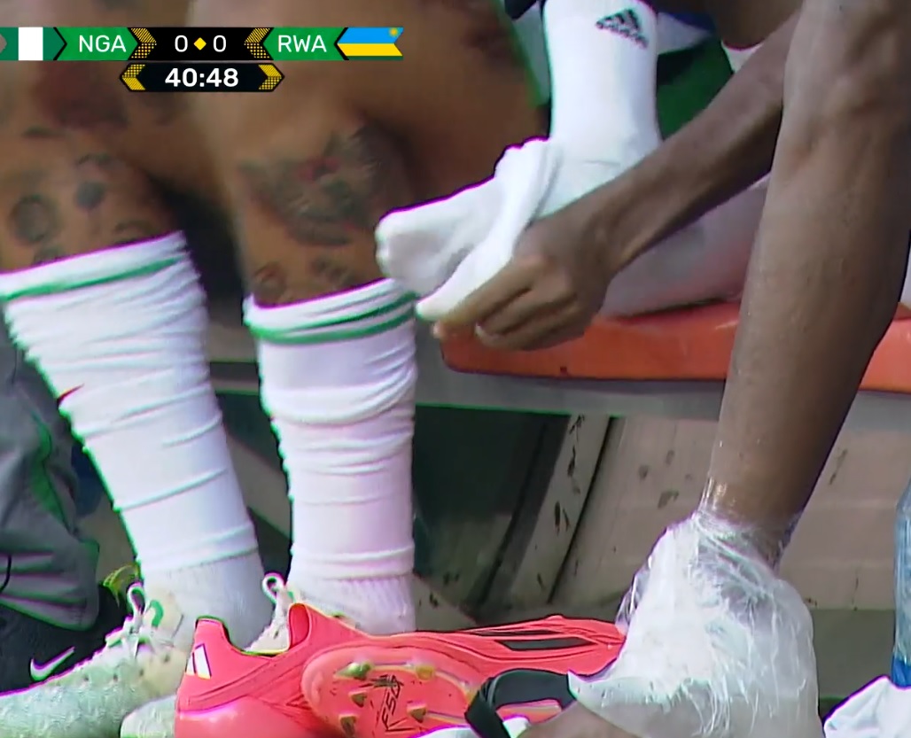 Osimhen Buz Tedavisi1