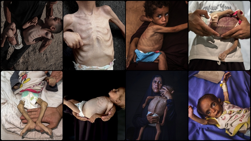 Thumbs B C 135C76A0793Ac3760A884F47D8Eaced5