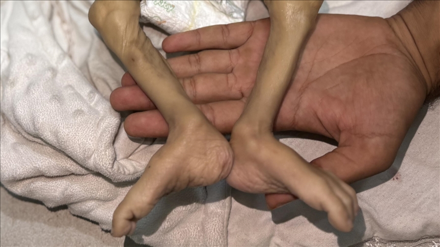 Thumbs B C 96Bb62B8F69E35D3B736F73736Ffe821