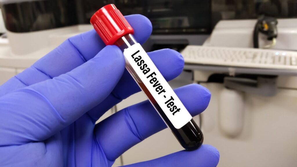 Lassa Atesi Tanisi Nasil Konur 1024X576