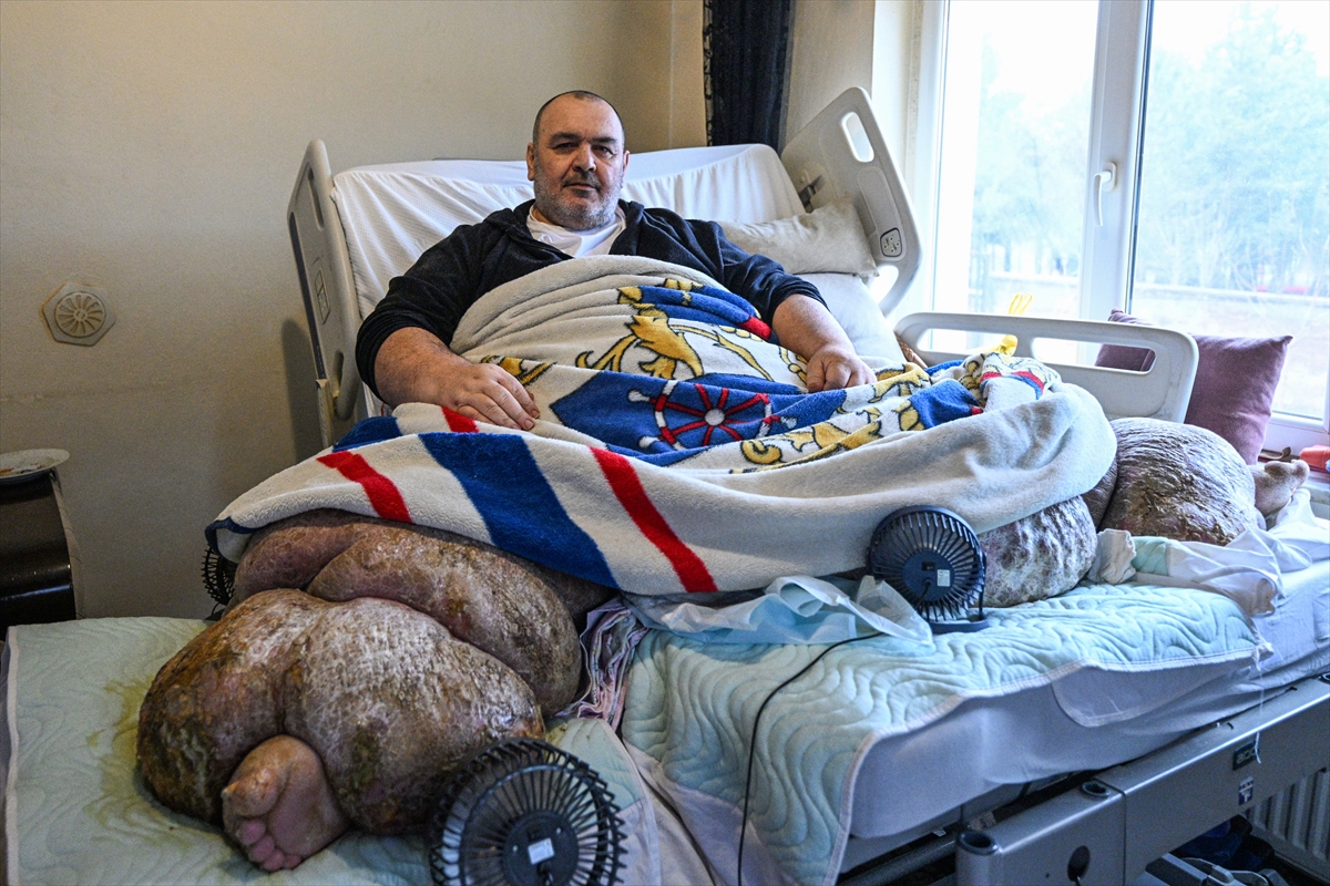 A A 20260213 40541208 40541200 K A Y S E R I D E Y A K L A S I K 300 K I L O L U K F I L H A S T A S I K I S I O Z E L E K I P L E E V I N D E N C I K A R I L I P H A S T A N E Y E S E V K E D I L D I