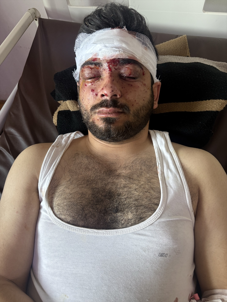 A A 20260217 40580827 40580824 S U R I Y E D E M A Y I N T E M I Z L E M E S I R A S I N D A K I P A T L A M A D A A A M U H A B I R I D A H I L 3 K I S I Y A R A L A N D I