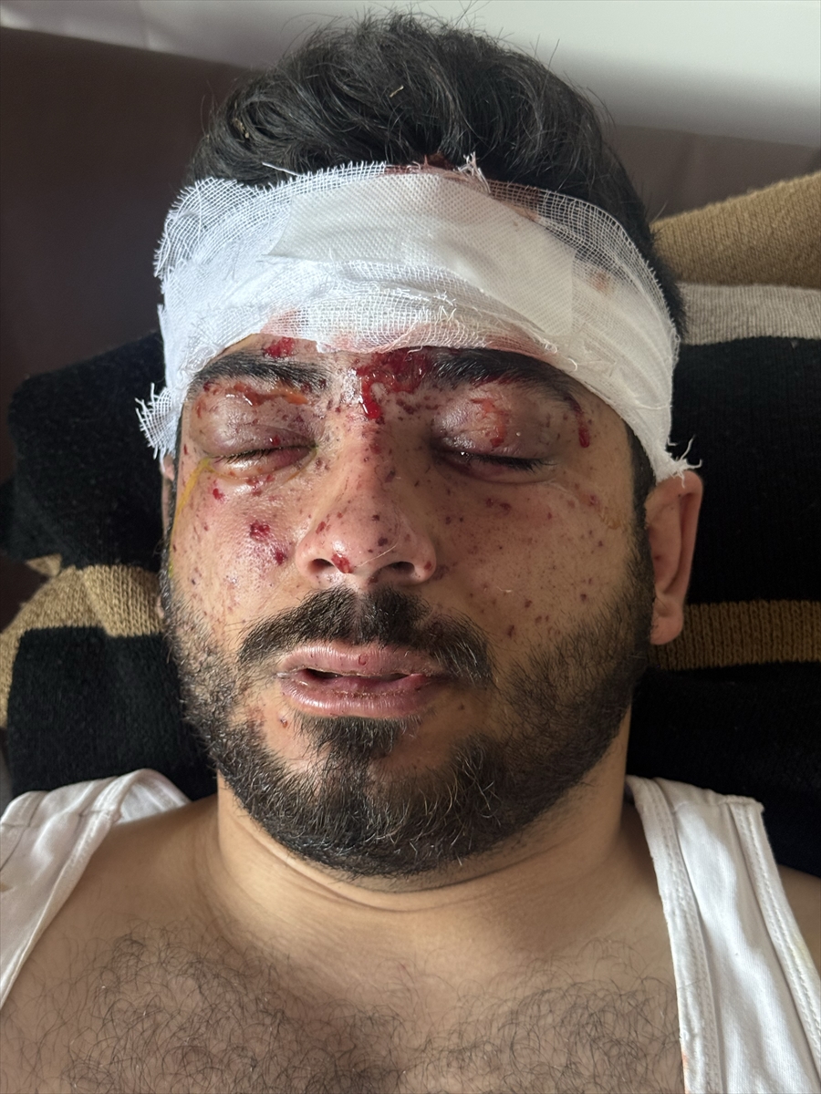 A A 20260217 40580827 40580825 S U R I Y E D E M A Y I N T E M I Z L E M E S I R A S I N D A K I P A T L A M A D A A A M U H A B I R I D A H I L 3 K I S I Y A R A L A N D I