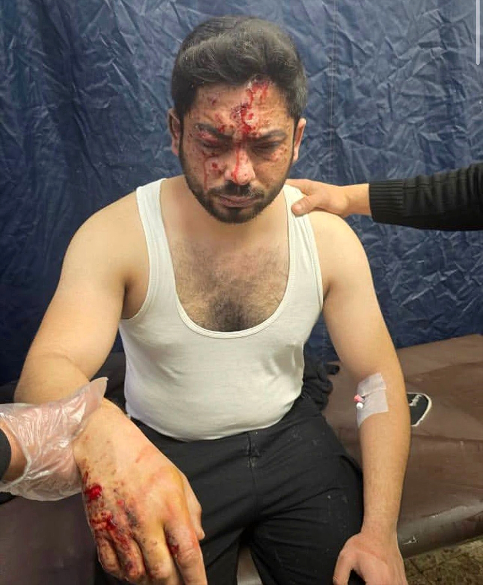 A A 20260217 40580827 40580826 S U R I Y E D E M A Y I N T E M I Z L E M E S I R A S I N D A K I P A T L A M A D A A A M U H A B I R I D A H I L 3 K I S I Y A R A L A N D I