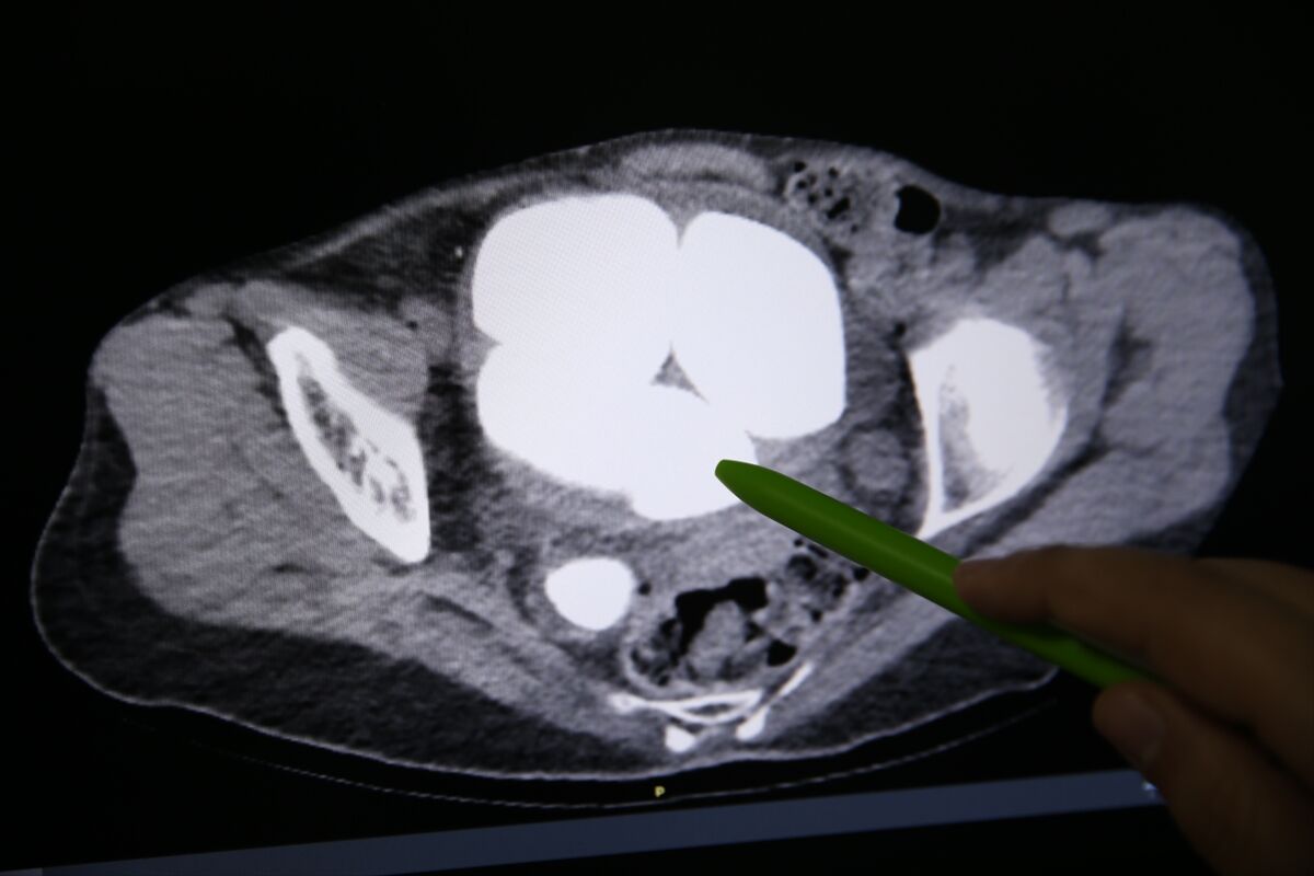 A A 20260331 40973108 40973097 I D R A R K A N A L I V E M E S A N E S I N D E N Y A R I M K I L O G R A M A G I R L I G I N D A 6 T A S C I K A R I L D I