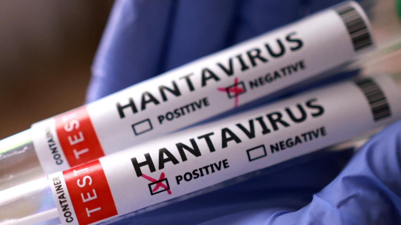 Hantavirus Reu 2459423
