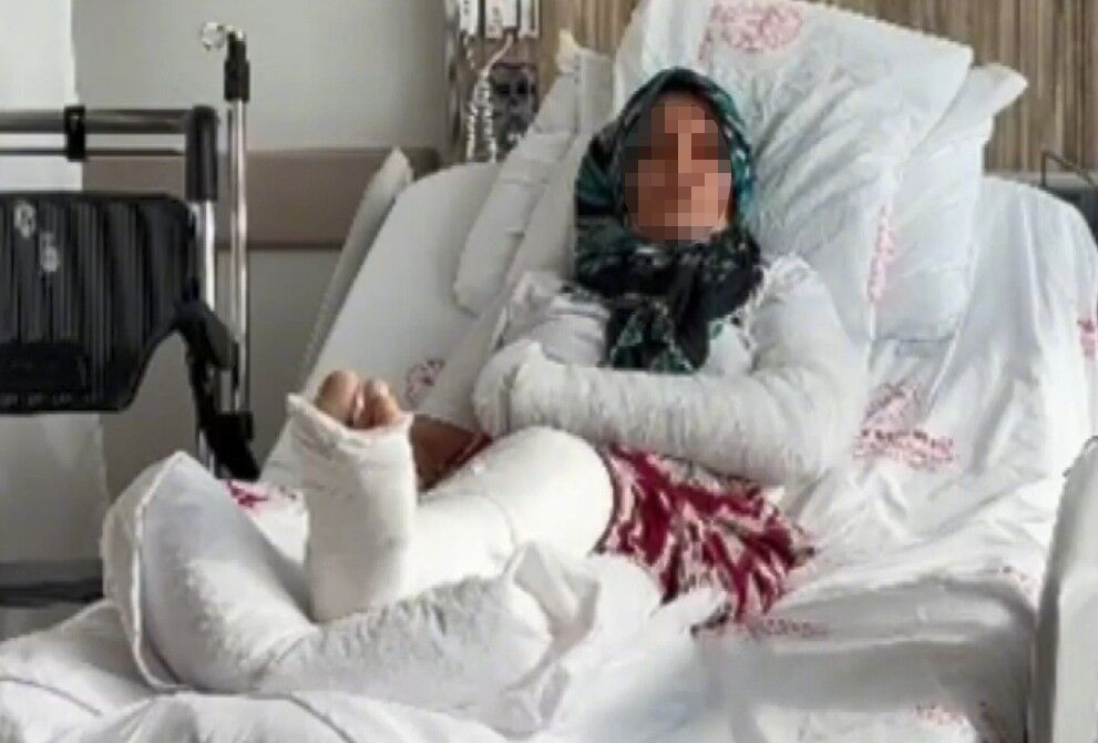 İş yerinde sopalı saldırıya uğradı: 3 çocuk annesi kadının kolu ve bacağı kırıldı